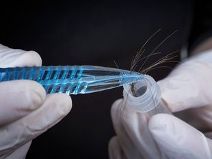Haaranalyse