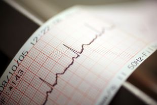 medizinprodukte-hersteller-dienstleister-haendler TÜV NORD CERT Zertifizierung Medizinprodukte