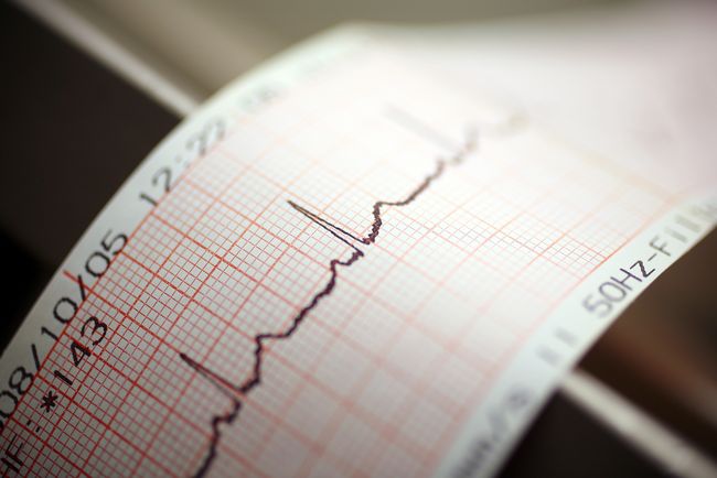 medizinprodukte-hersteller-dienstleister-haendler TÜV NORD CERT Zertifizierung Medizinprodukte